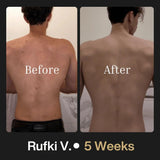 Shield Men's Acne Body Wash for Back, Chest & Shoulders - 4% Benzoyl Peroxide Body Wash, Clears Breakouts & Acne Scars – Unscented with Niacinamide, Glycolic Acid & Ceramides, 8.5 oz